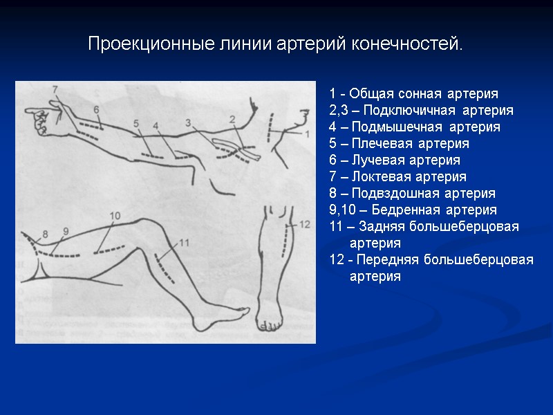 Проекционные линии артерий конечностей. 1 - Общая сонная артерия 2,3 – Подключичная артерия 4